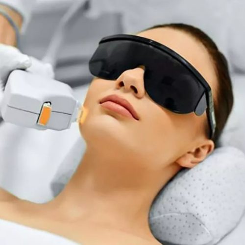 laser-facial laser-facial